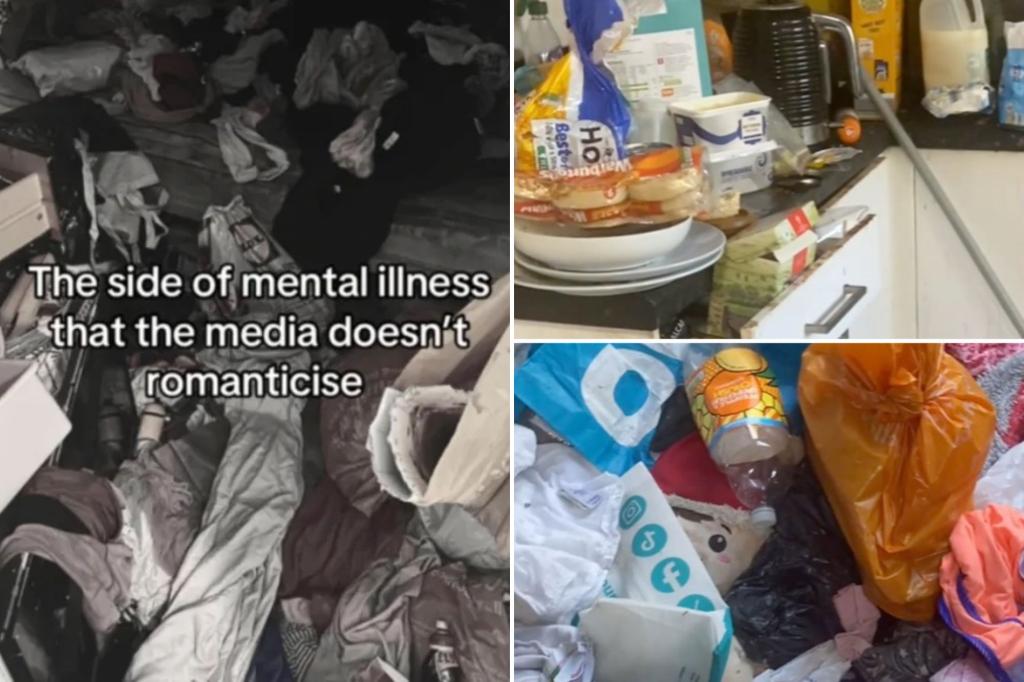 Tiktok users say this side of the mental illnesis does not need to be romanticized